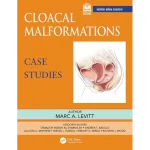 Cloacal Malformations Case Studies