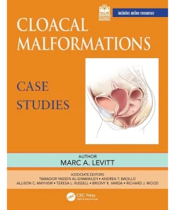 Cloacal Malformations Case Studies