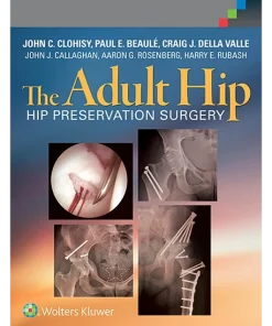The Adult Hip Hip Preservation Surgery