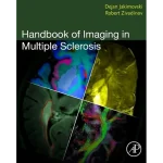 Handbook of Imaging in Multiple Sclerosis