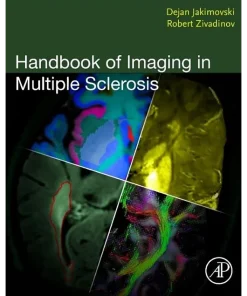 Handbook of Imaging in Multiple Sclerosis