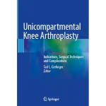 Unicompartmental Knee Arthroplasty