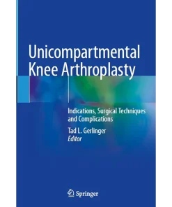 Unicompartmental Knee Arthroplasty