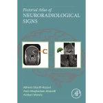 Pictorial Atlas of Neuroradiological Signs