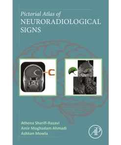 Pictorial Atlas of Neuroradiological Signs