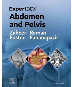 ExpertDDx Abdomen and Pelvis