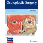 Oculoplastic Surgery