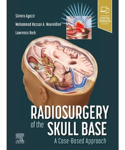 Radiosurgery of the Skull Base A Case-Based Approach