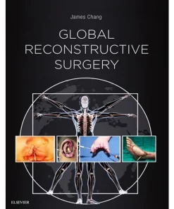 Global Reconstructive Surgery