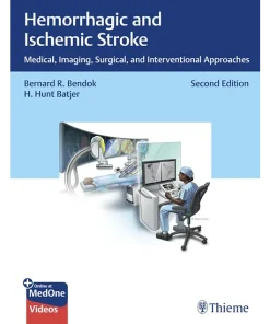 Hemorrhagic and Ischemic Stroke