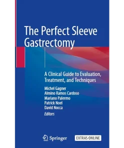 The Perfect Sleeve Gastrectomy