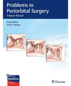 Problems in Periorbital Surgery A Repair Manual