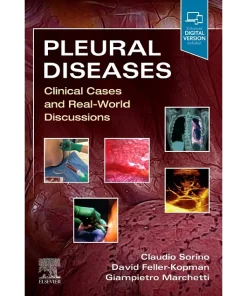 Pleural Diseases Clinical Cases and Real-World Discussions