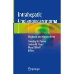 Intrahepatic Cholangiocarcinoma