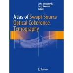 Atlas of Swept Source Optical Coherence Tomography