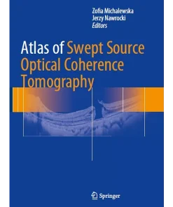 Atlas of Swept Source Optical Coherence Tomography