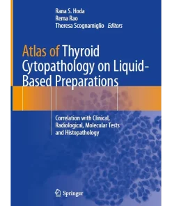 Atlas of Thyroid Cytopathology on Liquid-Based Preparations