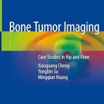 Bone Tumor Imaging