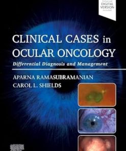 Clinical Cases in Ocular Oncology
