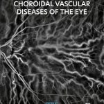 Retinal and Choroidal Vascular Diseases of the Eye