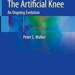 The Artificial Knee: An Ongoing Evolution