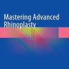 Mastering Advanced Rhinoplasty