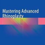 Mastering Advanced Rhinoplasty