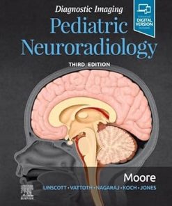Pediatric Neuroradiology