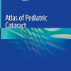 Atlas of Pediatric Cataract