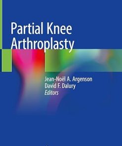 Partial Knee Arthroplasty