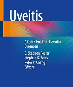 Uveitis
