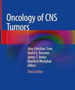 Oncology of CNS Tumors