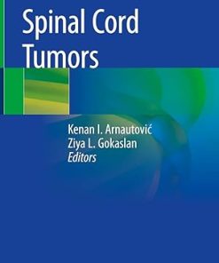Spinal Cord Tumors