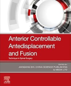 Anterior Controllable Antedisplacement and Fusion