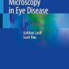 In Vivo Confocal Microscopy in Eye Disease
