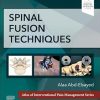 Spinal Fusion Techniques
