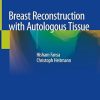 Breast Reconstruction with Autologous Tissue