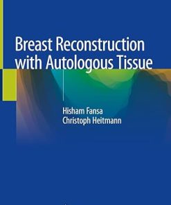 Breast Reconstruction with Autologous Tissue