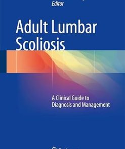 Adult Lumbar Scoliosis