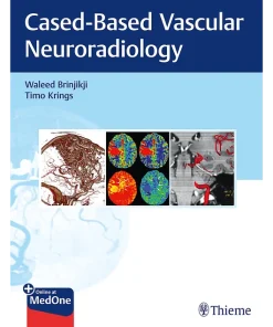 Imaging in Neurovascular Disease A Case-Based Approach
