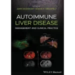 Autoimmune Liver Disease Management and Clinical Practice