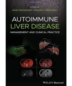 Autoimmune Liver Disease Management and Clinical Practice