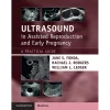 Ultrasound in Assisted Reproduction and Early Pregnancy