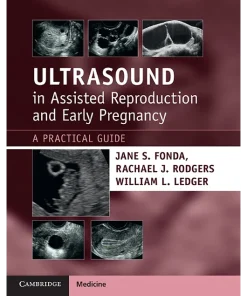 Ultrasound in Assisted Reproduction and Early Pregnancy