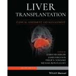 Liver Transplantation Clinical Assessment and Management
