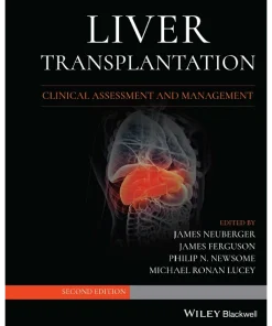 Liver Transplantation Clinical Assessment and Management