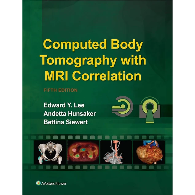 Computed Body Tomography with MRI Correlation