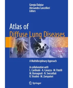 Atlas of Diffuse Lung Diseases A Multidisciplinary Approach
