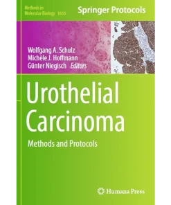 Urothelial Carcinoma Methods and Protocols