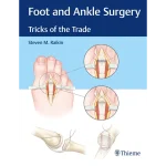 Foot and Ankle Surgery Tricks of the Trade